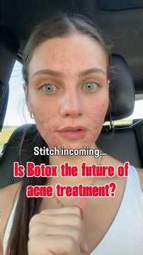 Can Botox Treat Acne? Here's What We Know
