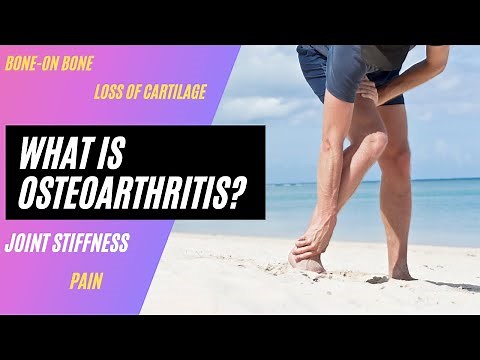 What is Foot Osteoarthritis?