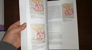 13 reactions · 3 comments | #Lippincott_Illustrated_Reviews 7th Edition | Palestine Medical Books | Facebook