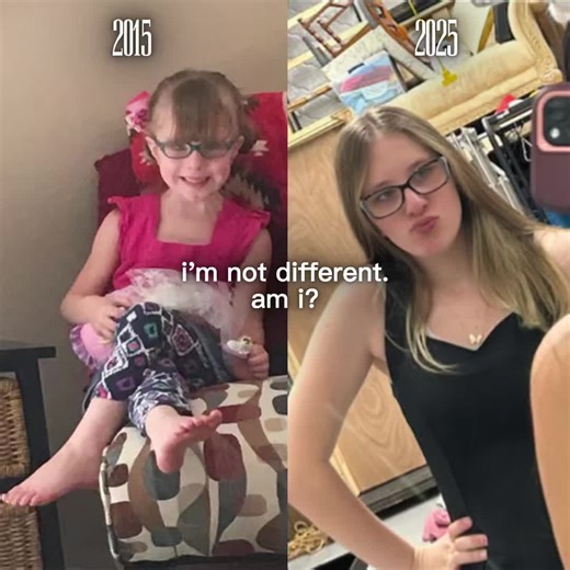 #CapCut #fyp why I look like that, I had bangs, but they look so weird | bangs hair