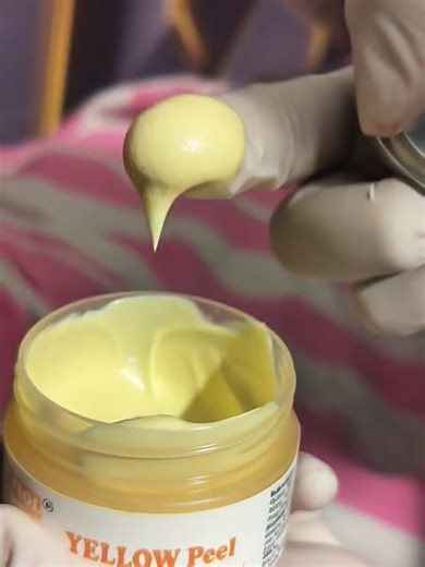 yellow peel for pigmentation.