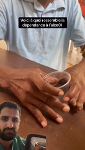 C’est hyper triste! La dépendance à l’alcool est une vraie pathologie qui modifie le fonctionnement du cerveau et provoque de nombreux dégâts. Si vous êtes concernés faites vous accompagner, les professionnels de santé sont la pour ça! N’envisagez pas un sevrage à la « sauvage » sans traitement associé car cela peut être dangereux ! #medical #santé #alcool #vulgarisation #deliriumtremens #cirrhose #soignant #vin | Le.medecin.anesthesiste