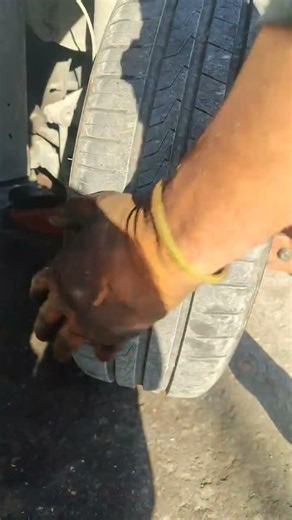 How to diagnose a broken sternum