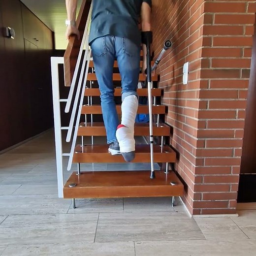 Treppensteigen HOCH mit Krücken (Mit Geländer) – Die sicherste Technik