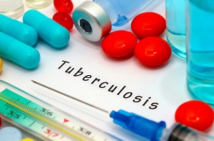 New genetics tool helps guide dosages of tuberculosis drug
