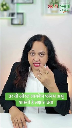 Noticed a white patch on your skin?