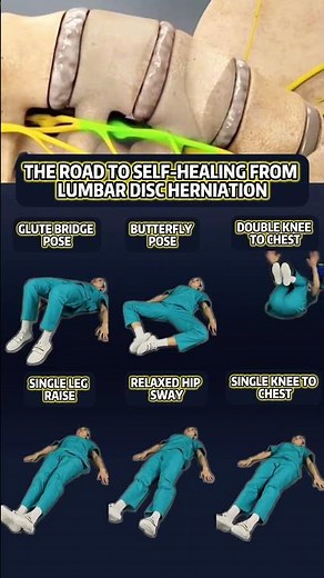 HEAL Your Lumbar Disc Herniation with Simple Exercises