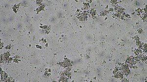 coughing, Phlegm and mucus under the microscope