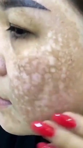 505K views · 1.2K reactions | Best Tan Removal Pack | Get Fair & Smooth Skin . . . #skincare #skinbrightening #tanning #suntan #tanningremoval #suntanremoval #fairskin #facetan #trending #reels #beautytips #explore #viral #homeremdies #skincare #explorepage | Beauty recipes | Facebook