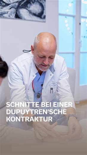 🖐️ Was ist die Dupuytren’sche Kontraktur? Eine gutartige Veränderung der Bindegewebsstränge in der Hand – die Finger krümmen sich, lassen sich nicht mehr strecken. ✂️ Der Schnitt? Entweder gerade mit kleinen Entlastungsschnitten – oder zickzackförmig über die Gelenke. 📱 Fragen? WhatsApp: 43 664 439 45 49 📺 Mehr OP-Einblicke: www.youtube.com/@DrStefanGaerner #drstefangärner #handchirurgie #dupuytren #praxiswien #viennabeauty #funktionvorform #realresults #theartofbeauty | Dr. Stefan Gärner