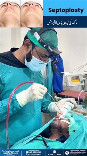 Dr. Huzaifa Performing Deviated Septum Surgery | Septoplasty Surgery 👃🏥