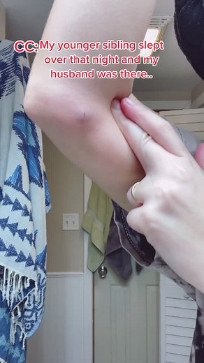 Mysterious Lump on Arm: Alien Encounter Revealed