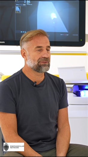 Embolizarea strică uterul – cel mai răspândit mit, explicat de un medic! Adevărul medical? Nu embolizarea afectează uterul, ci fibromul netratat. Embolizarea nu lasă cicatrici, nu taie și nu „strică” uterul — dimpotrivă, îl salvează. Este o metodă minim invazivă, cu recuperare rapidă pentru femeile care vor să-și păstreze feminitatea și fertilitatea, ne-a povestit dr Rareş Nechifor, medic radiolog intervenţionist în ep 21 al podcastului Fără bisturiu by Endovascular Network pe canalul de Youtube