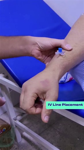 How IV Therapy Works: A Quick Look at IV Access 💉