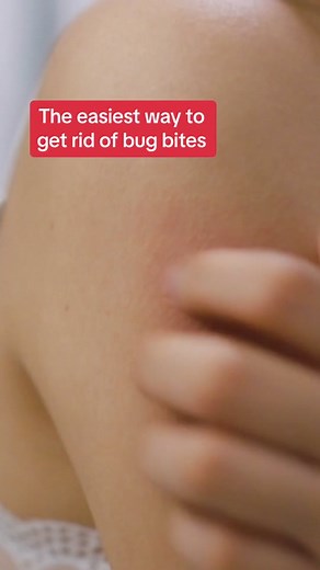 Effective Bug Bite Relief Using Your Hair Dryer