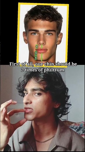 How to fix recessed chin