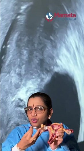 ఎస్.హెచ్.జి అంటే ఏమిటి? | Mamata Fertility Hospital: Hyderabad