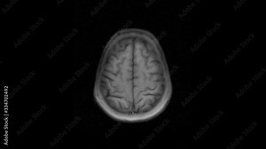 Brain MRI, head scans and tumor detection. Diagnostic medical tool