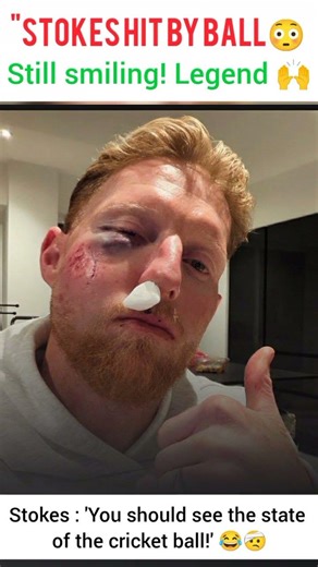 😱🤕 Ben Stokes ka chehra dekh lo, ball ki halat kharab! 😂 ' – Stokesy style! #BenStokes