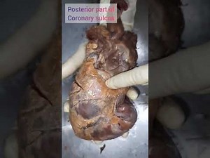 Internal features of Left atrium & ventricle of human heart