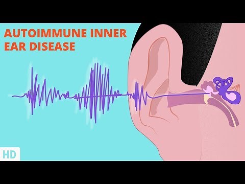 Battling Autoimmune Inner Ear Disease: Treatment Options and Prognosis