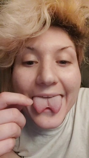 Understanding Bifurcation Regrowth: Can Your Tongue Split Heal?