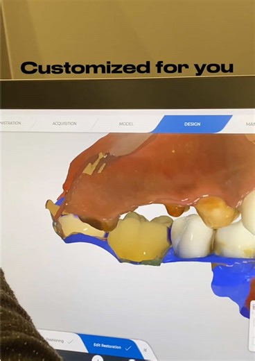 Behind every stunning smile is a digital masterpiece. 💎 Experience the future of dentistry with our precision 3D scanning and custom-made designs. 🦷✨ #DigitalDentistry #SmileDesign #ModernDentistry #3DScanning #DentalTech