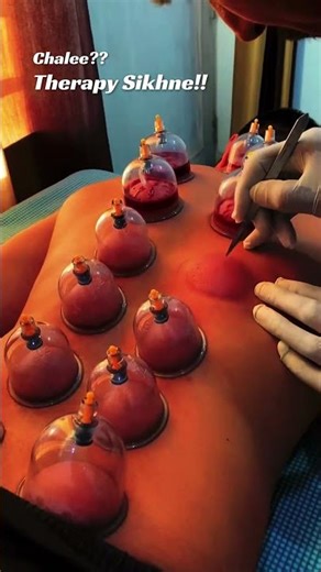 Acupressure, Acupuncture, Cupping, Hijama and other therapies can heal the body without medicines!