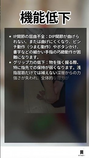 理学療法士・作業療法士向け！手指のDIP関節を動かす唯一の筋肉「深指屈筋（FDP）」の基本を解説！#深指屈筋 #手指屈筋 #理学療法士 #作業療法士 #リハビリ #解剖学 #筋肉 #shorts