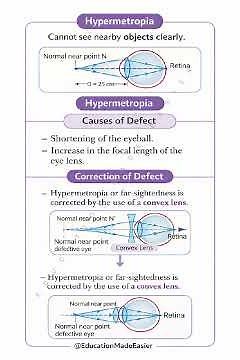 Hypermetropia Explained | Far-Sightedness | Human Eye Class 10 | Ray Diagram + Correction