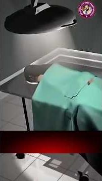 Stapler Surgery for Hemorrhoids? Watch This! #StaplerSurgery #Shorts #Doctor