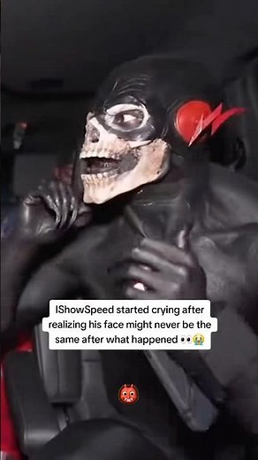 IshowSpeed Crying after realizing his face might never be the same after what happend 😭#ishowspeed