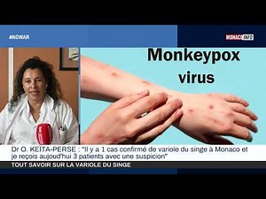 Santé : Tout savoir sur la variole du singe