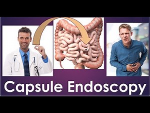 Capsule endoscopy