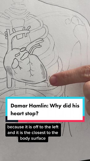 Understanding Cardiac Arrest: Commotio Cordis Explained