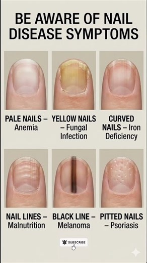 Be Aware of Nail Disease Symptoms | Real Human Nails