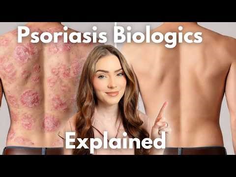 Psoriasis Biologics Explained | Types, Mechanisms, and What You Should Know