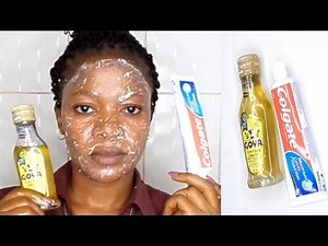 EVERYNIGHT APPLY COLGATE TOOTHPASTE AND OLIVE OIL WATCH WHAT HAPPENS TO YOUR FACE IN 5 MINUTE