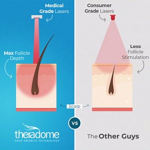 No matter how much hair is gone — it CAN come back. Stimulate growth safely and comfortably with Theradome, the most cutting-edge, clinical-strength hair growth method recommended by 4 out of 5 hair loss professionals. Voice-guided. Laser-Focused. User friendly. 100% safe. | Theradome | Facebook