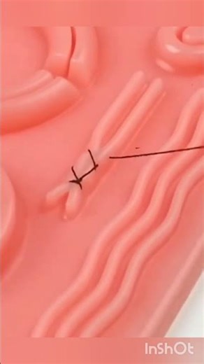 “Continuous Suturing Technique Explained — Easy & Fast Surgical Skill!
