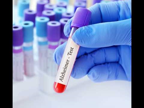 Blood Test Breakthrough: Predicting Dementia 25 Years in Advance
