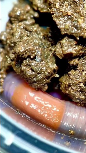 Earthworm under the microscope!