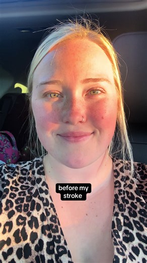 4 years ago I had a stroke, and I thought my life was over…turns out, it was just the beginning 💗💪🏼🥳 #livingwithanavm #strokesurvivor #avmawareness #avmwarrior #strokewarrior