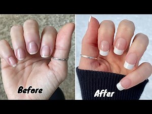 How to grow nails in 1 days || How to grow nails fast || How to grow nails fast overnight ||