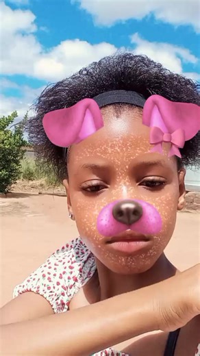 afro hun🥺🩷🩷