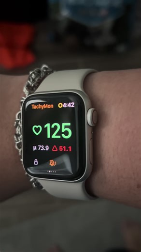 My POTS and a small migraine where really kicking my but today. #fyp #POTS #potssyndrome #hemiplegicmigraine #potsawareness