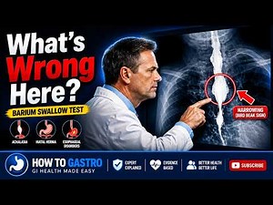 Barium Swallow Test Explained | Esophageal Disorders, Achalasia, Hiatal Hernia