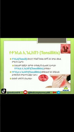 Tonsillitis Explained: Symptoms, Causes, and Treatment #Tonsillitis #HealthTips #የቶንሲል_ኢንፌክሽን