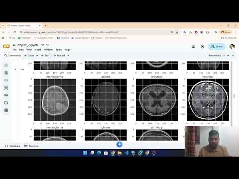 A Comparative Analysis of Deep Learning Models for Classification Using Image Data