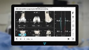 Robotic-Assisted Femur First Measured Resection Total Knee Arthroplasty with Dr. David Dalury